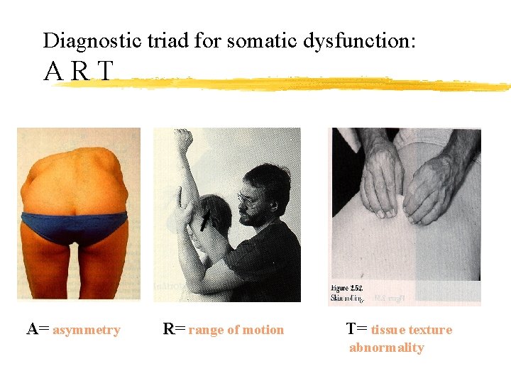 Diagnostic triad for somatic dysfunction: ART A= asymmetry R= range of motion T= tissue
