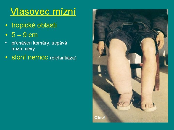 Vlasovec mízní • tropické oblasti • 5 – 9 cm • přenášen komáry, ucpává