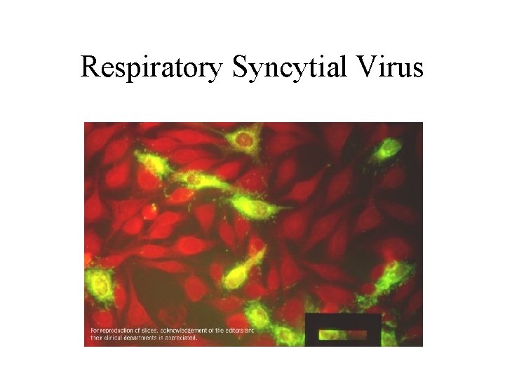 Respiratory Syncytial Virus Respiratory Syncytial Virus