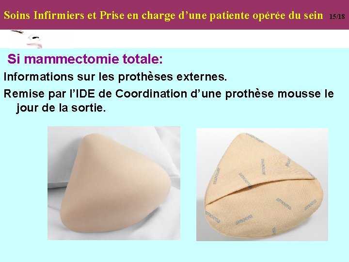 Soins Infirmiers et Prise en charge d’une patiente opérée du sein 15/18 Si mammectomie