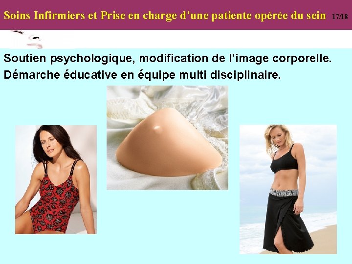 Soins Infirmiers et Prise en charge d’une patiente opérée du sein Soutien psychologique, modification