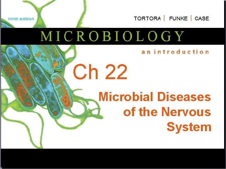 Ch 22 Microbial Diseases of the Nervous System 