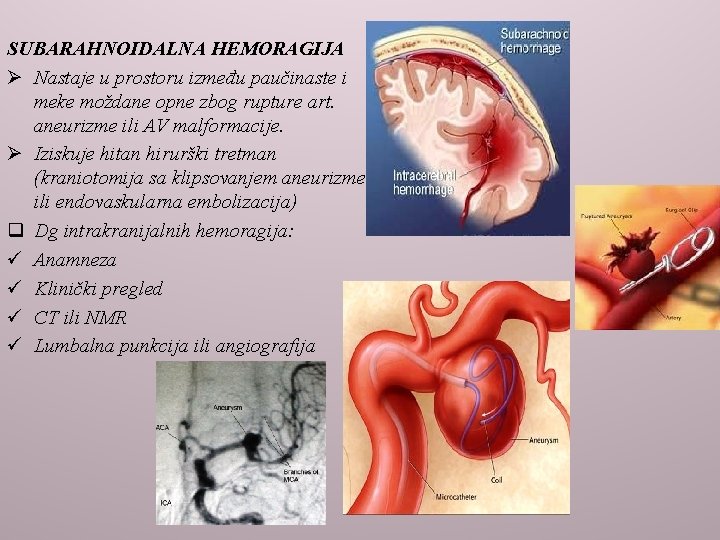 SUBARAHNOIDALNA HEMORAGIJA Ø Nastaje u prostoru između paučinaste i meke moždane opne zbog rupture