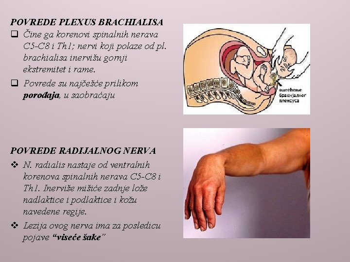 POVREDE PLEXUS BRACHIALISA q Čine ga korenovi spinalnih nerava C 5 -C 8 i