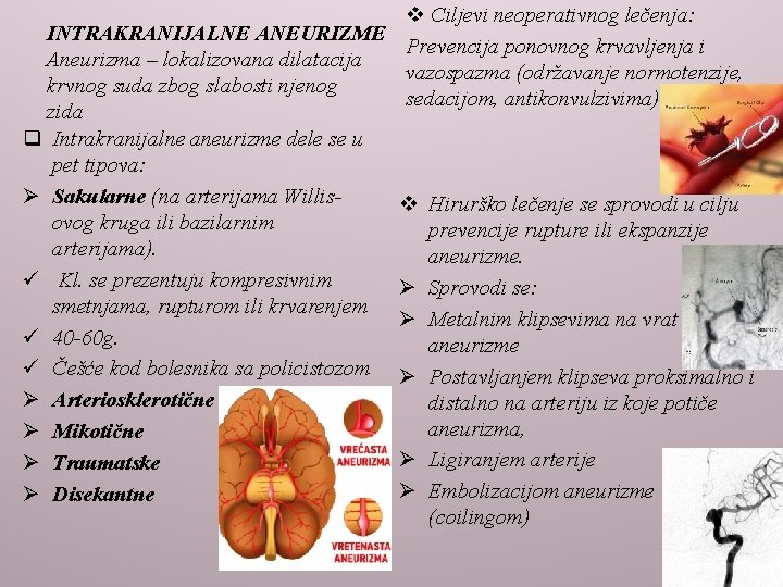 v Ciljevi neoperativnog lečenja: INTRAKRANIJALNE ANEURIZME Prevencija ponovnog krvavljenja i Aneurizma – lokalizovana dilatacija