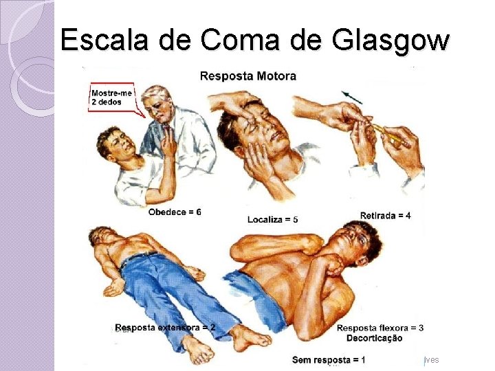 Escala de Coma de Glasgow Prof. Fernando Ramos Gonçalves 
