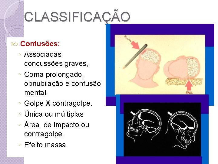 CLASSIFICAÇÃO Contusões: ◦ Associadas concussões graves, ◦ Coma prolongado, obnubilação e confusão mental. ◦