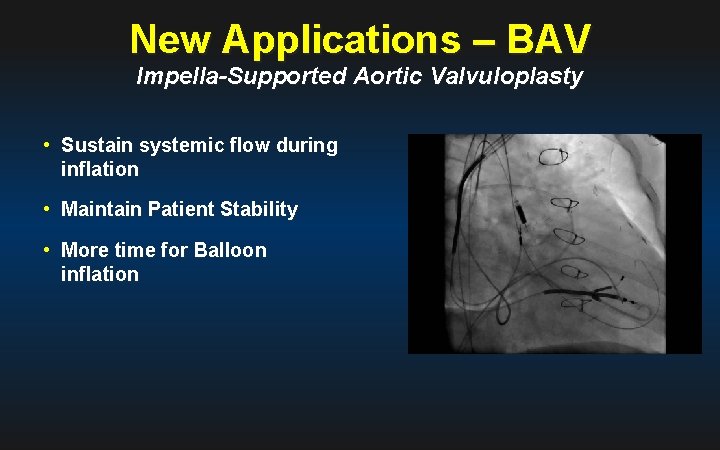 New Applications – BAV Impella-Supported Aortic Valvuloplasty • Sustain systemic flow during inflation •