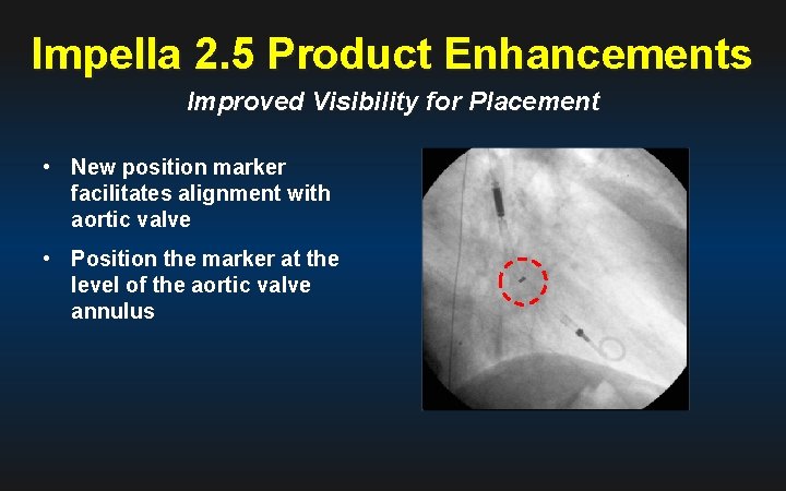 Impella 2. 5 Product Enhancements Improved Visibility for Placement • New position marker facilitates