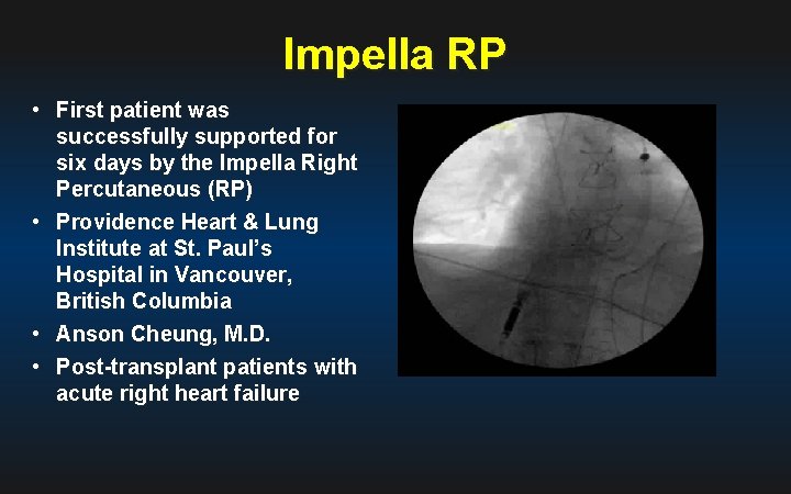 Impella RP • First patient was successfully supported for six days by the Impella