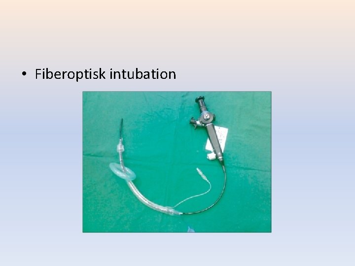  • Fiberoptisk intubation 