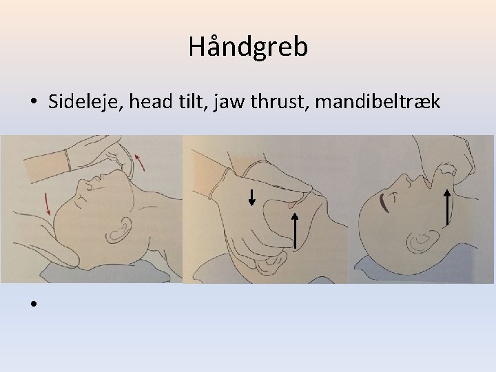 Håndgreb • Sideleje, head tilt, jaw thrust, mandibeltræk • 