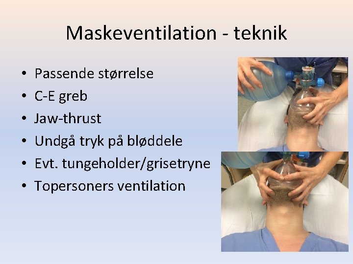 Maskeventilation - teknik • • • Passende størrelse C-E greb Jaw-thrust Undgå tryk på