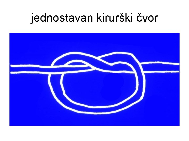 jednostavan kirurški čvor 