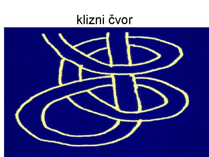klizni čvor 