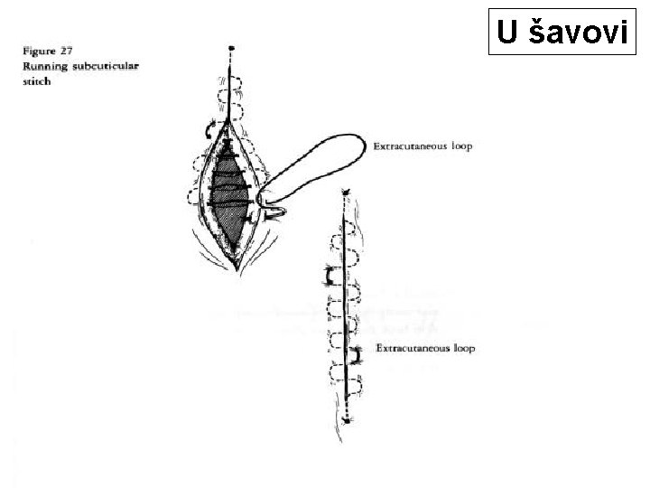 U šavovi 