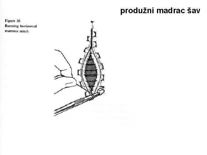 produžni madrac šav 