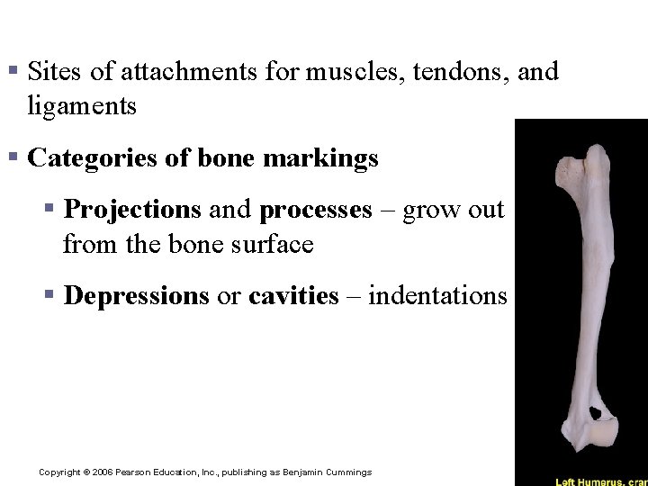 Bone Markings § Sites of attachments for muscles, tendons, and ligaments § Categories of