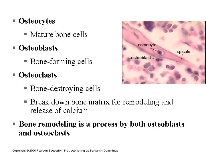 Types of Bone Cells § Osteocytes § Mature bone cells § Osteoblasts § Bone-forming