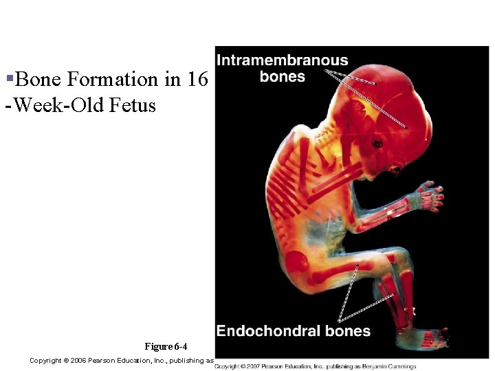 Bone Formation and Growth §Bone Formation in 16 -Week-Old Fetus Figure 6 -4 Copyright