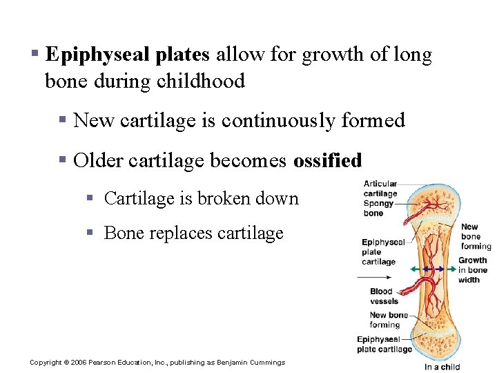 Bone Growth § Epiphyseal plates allow for growth of long bone during childhood §