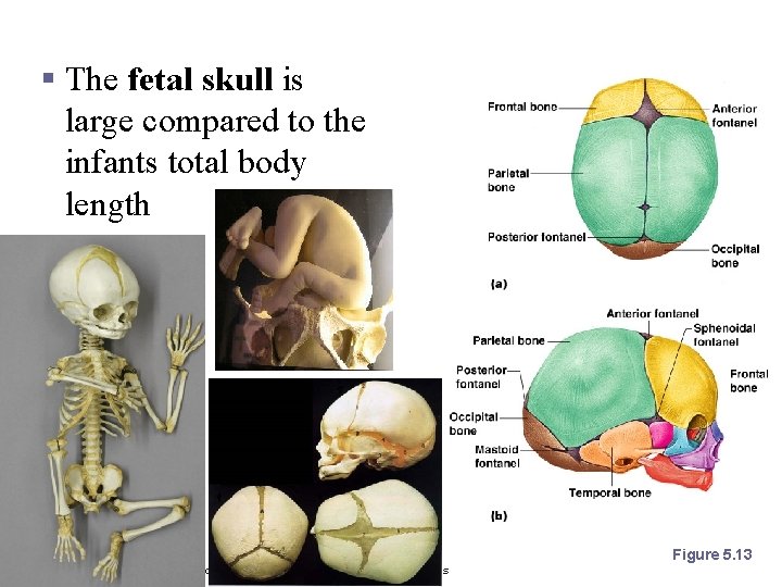 The Fetal Skull § The fetal skull is large compared to the infants total