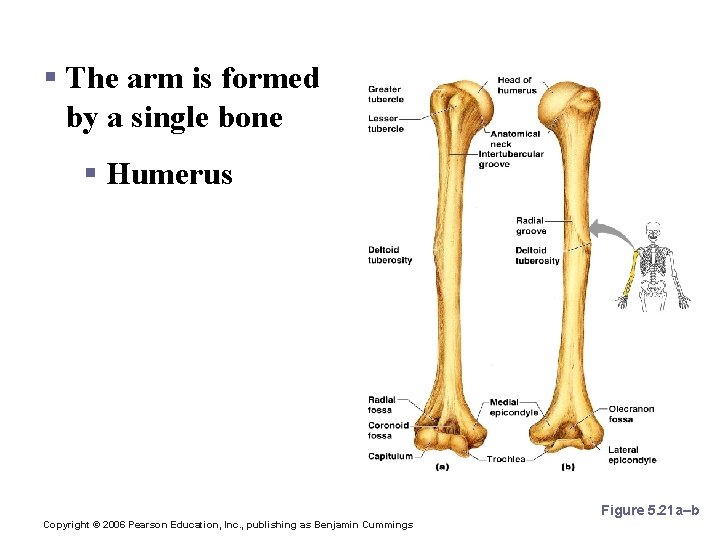 Bones of the Upper Limb § The arm is formed by a single bone