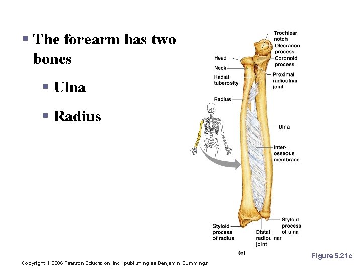 Bones of the Upper Limb § The forearm has two bones § Ulna §