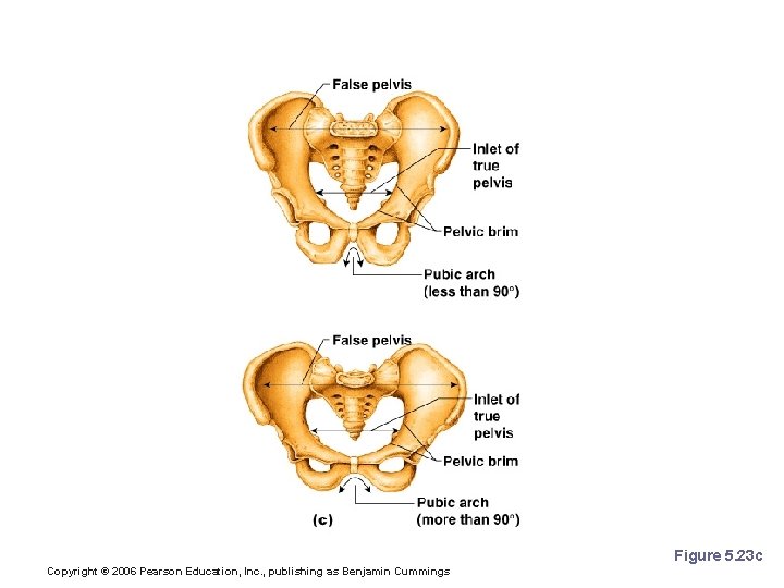 Gender Differences of the Pelvis Figure 5. 23 c Copyright © 2006 Pearson Education,