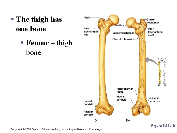 Bones of the Lower Limbs § The thigh has one bone § Femur –