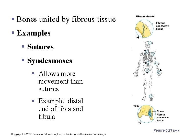 Fibrous Joints § Bones united by fibrous tissue § Examples § Sutures § Syndesmoses