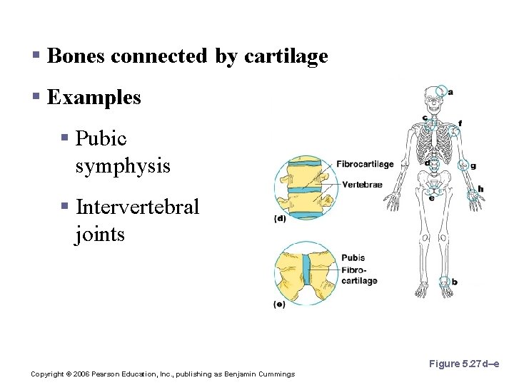 Cartilaginous Joints § Bones connected by cartilage § Examples § Pubic symphysis § Intervertebral