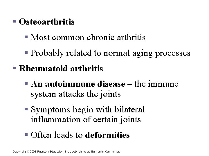 Clinical Forms of Arthritis § Osteoarthritis § Most common chronic arthritis § Probably related