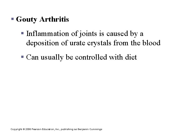 Clinical Forms of Arthritis § Gouty Arthritis § Inflammation of joints is caused by