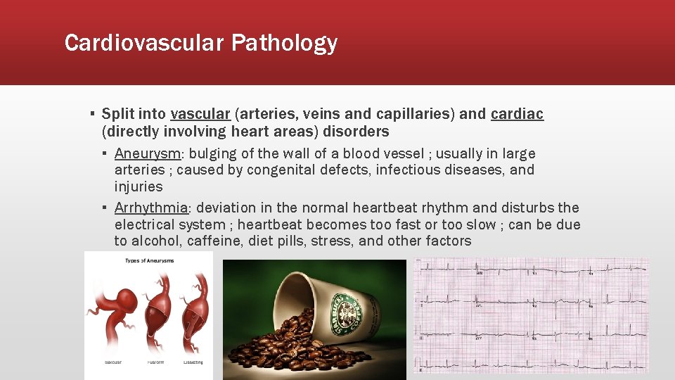 Cardiovascular Pathology ▪ Split into vascular (arteries, veins and capillaries) and cardiac (directly involving