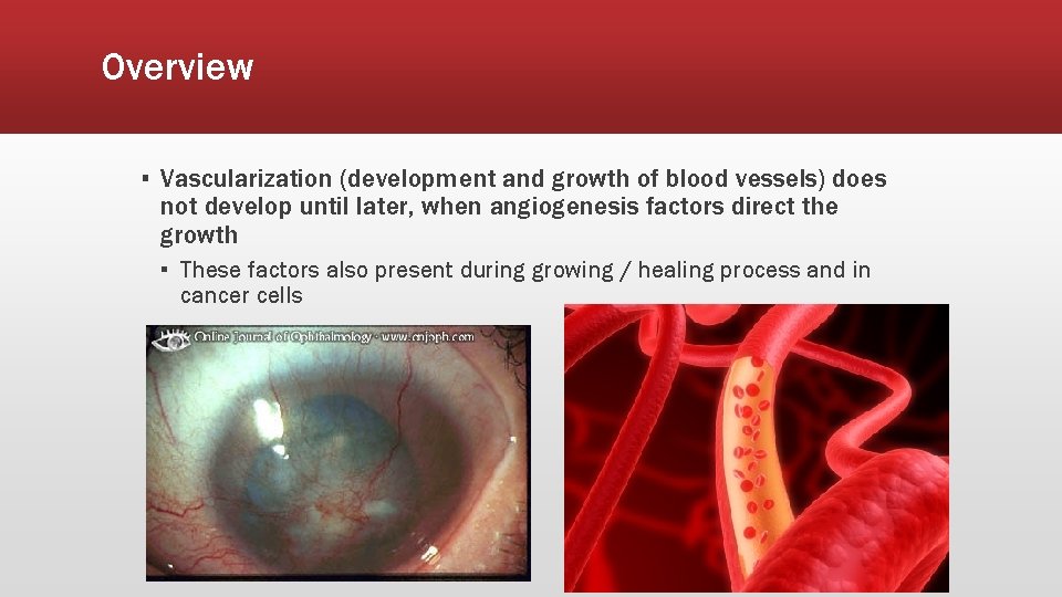 Overview ▪ Vascularization (development and growth of blood vessels) does not develop until later,