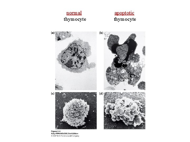 normal thymocyte apoptotic thymocyte 