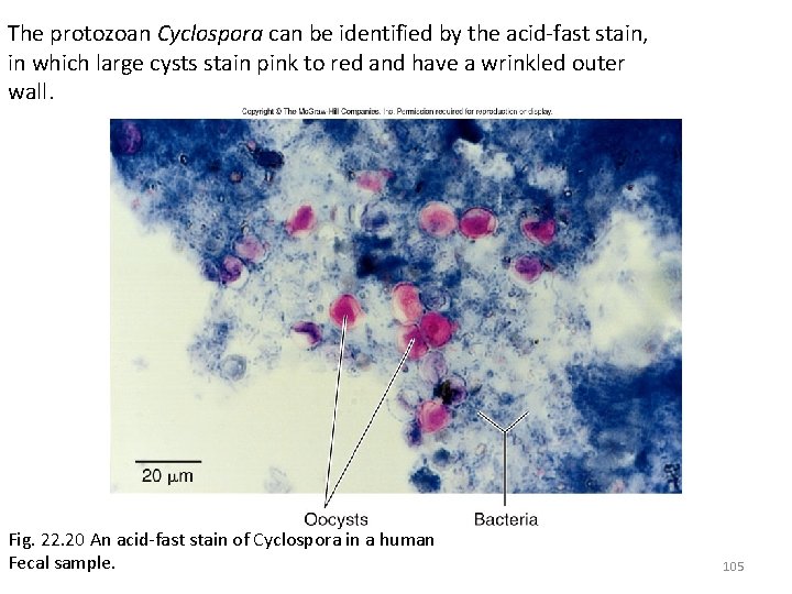 The protozoan Cyclospora can be identified by the acid-fast stain, in which large cysts