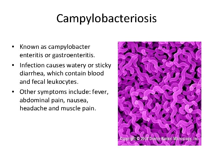 Campylobacteriosis • Known as campylobacter enteritis or gastroenteritis. • Infection causes watery or sticky