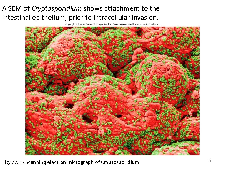 A SEM of Cryptosporidium shows attachment to the intestinal epithelium, prior to intracellular invasion.