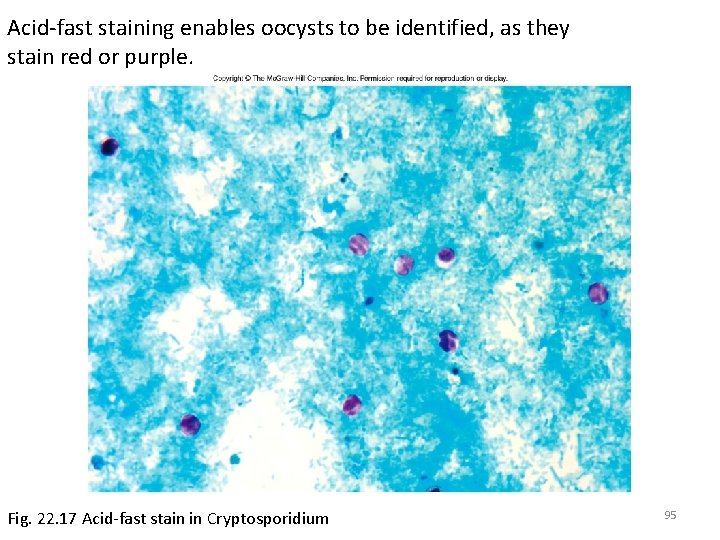 Acid-fast staining enables oocysts to be identified, as they stain red or purple. Fig.