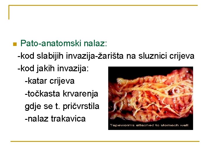 n Pato-anatomski nalaz: -kod slabijih invazija-žarišta na sluznici crijeva -kod jakih invazija: -katar crijeva