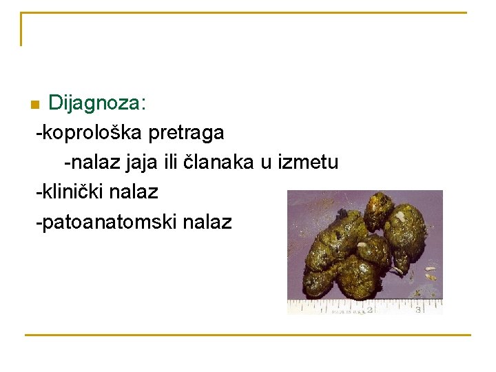 Dijagnoza: -koprološka pretraga -nalaz jaja ili članaka u izmetu -klinički nalaz -patoanatomski nalaz n