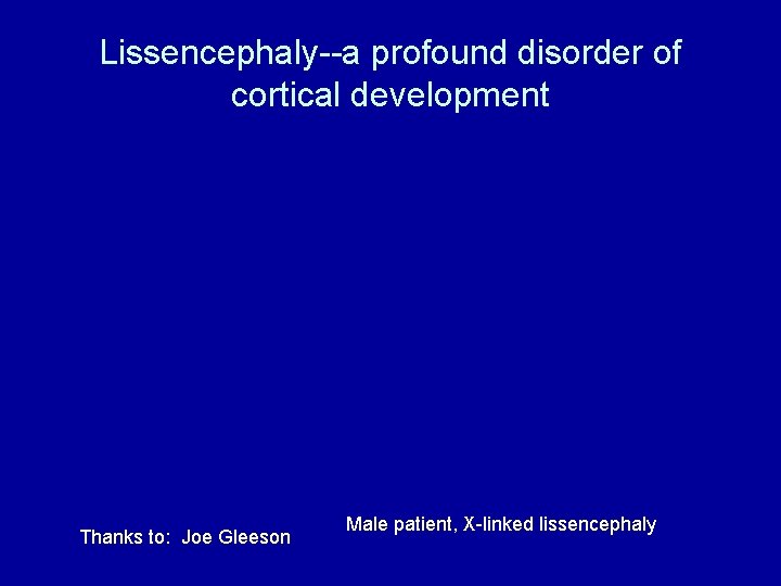 Lissencephaly--a profound disorder of cortical development Thanks to: Joe Gleeson Male patient, X-linked lissencephaly