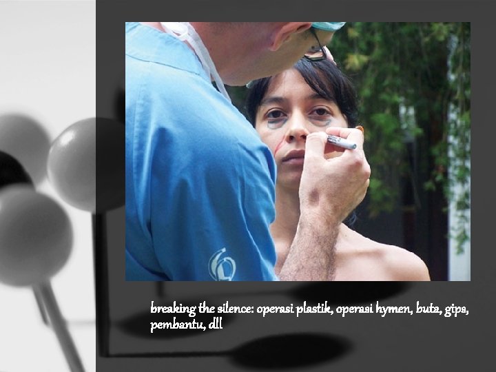 breaking the silence: operasi plastik, operasi hymen, buta, gips, pembantu, dll 