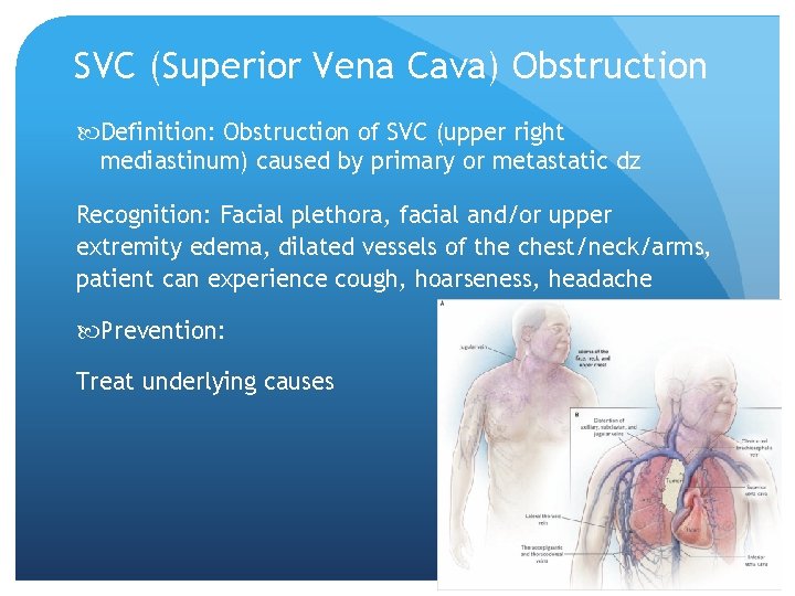 SVC (Superior Vena Cava) Obstruction Definition: Obstruction of SVC (upper right mediastinum) caused by