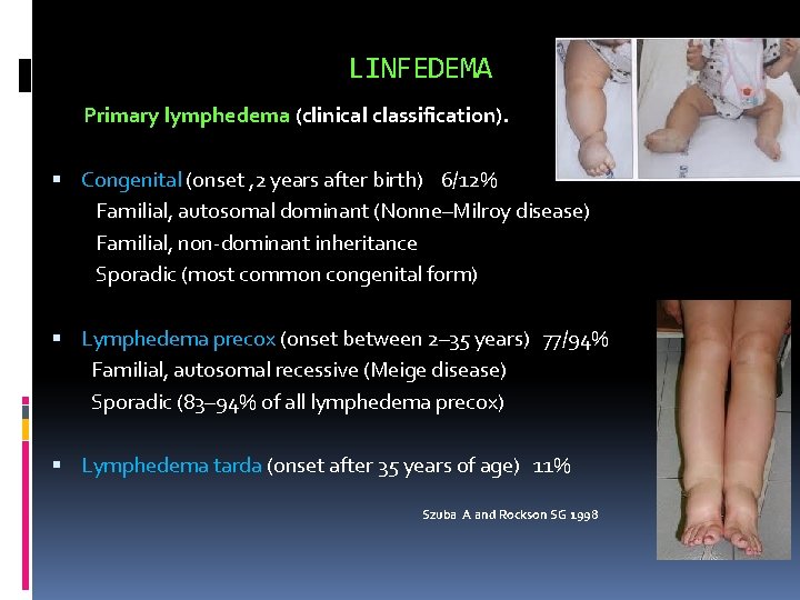 LINFEDEMA Primary lymphedema (clinical classification). Congenital (onset , 2 years after birth) 6/12% Familial,