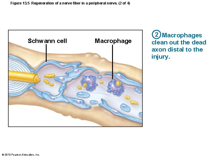 Figure 13. 5 Regeneration of a nerve fiber in a peripheral nerve. (2 of Figure 13. 5 Regeneration of a nerve fiber in a peripheral nerve. (2 of