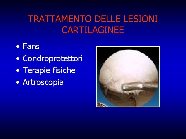 TRATTAMENTO DELLE LESIONI CARTILAGINEE • • Fans Condroprotettori Terapie fisiche Artroscopia 