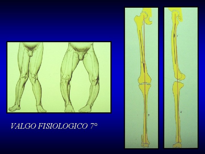 VALGO FISIOLOGICO 7° 